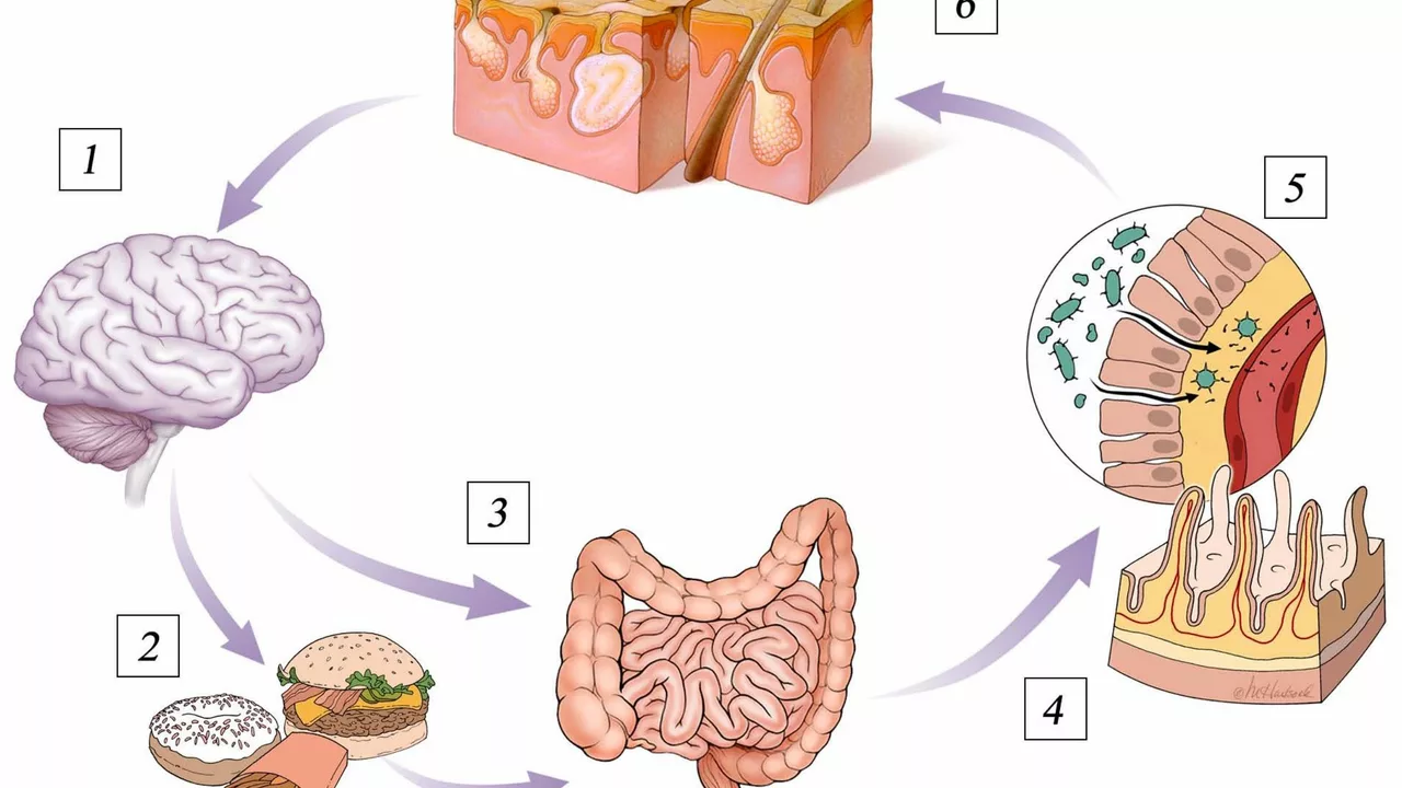 The Connection Between Acne and Gut Health: What You Need to Know
